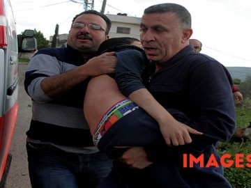 Palestinian protesters carry an injured comrade during clashes with Israeli security forces following a demonstration against the expropriation of Palestinian land by Israel in the village of Kfar Qaddum, near Nablus, in the occupied West Bank, on March 4, 2016. / Photographer: Mohammed Turabi  Images Live